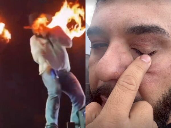 Cantor Léo mostra o rosto após queimaduras durante show em Pontal, no interior de São Paulo