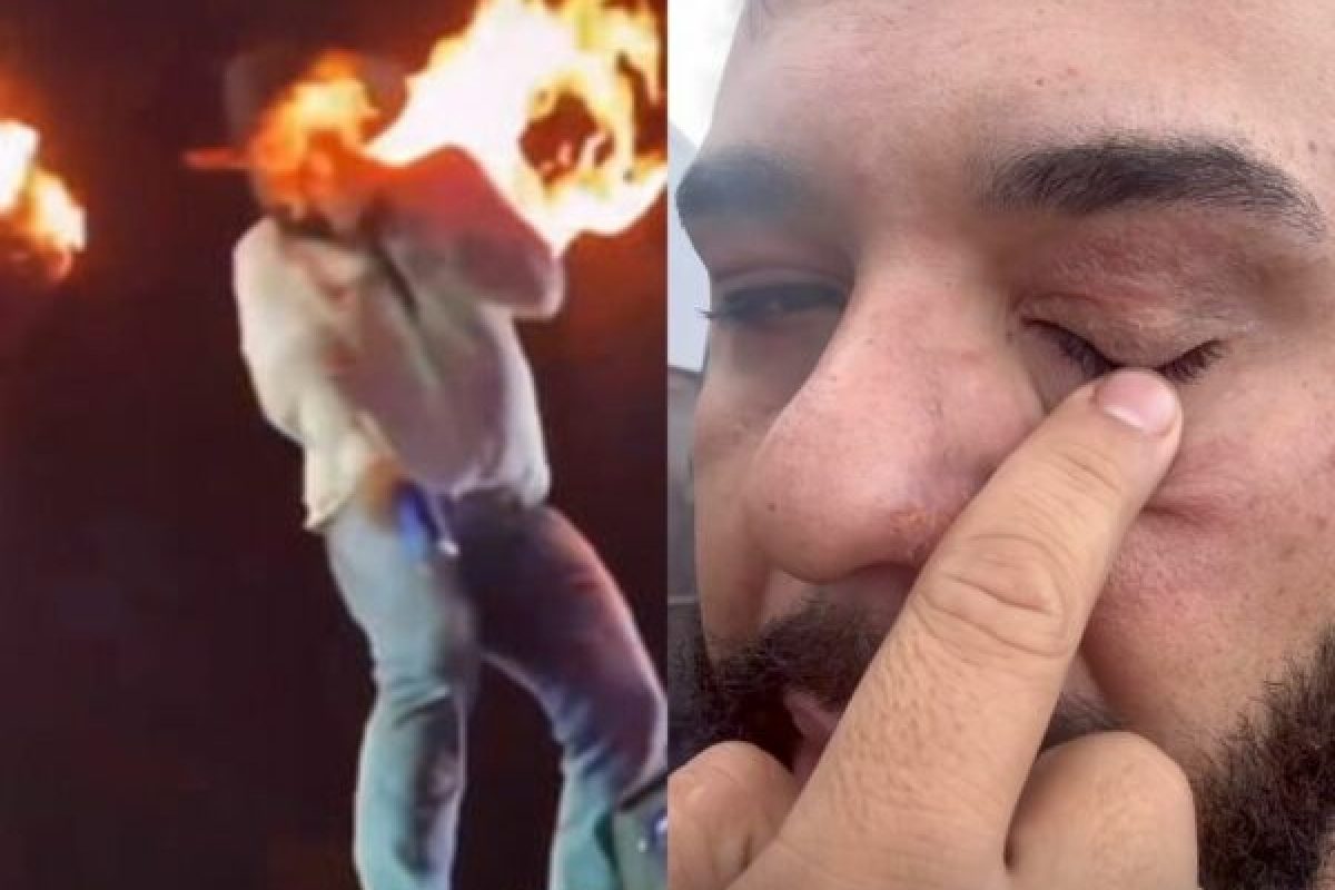 Cantor Léo mostra o rosto após queimaduras durante show em Pontal, no interior de São Paulo